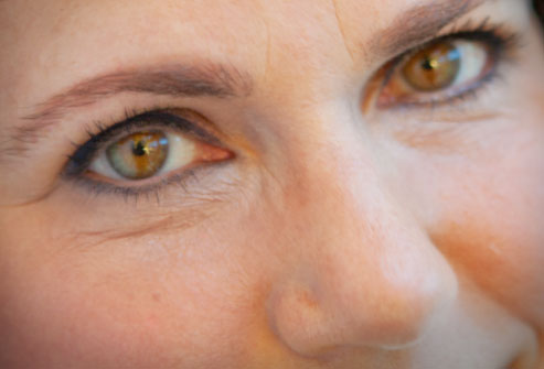 Τι απειλεί την υγεία των ματιών σας το καλοκαίρι;